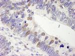 USP28 Antibody in Immunohistochemistry (Paraffin) (IHC (P))