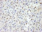 MED12 Antibody in Immunohistochemistry (Paraffin) (IHC (P))