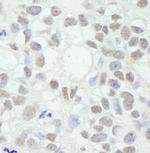 MED12 Antibody in Immunohistochemistry (Paraffin) (IHC (P))