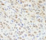 Sin1 Antibody in Immunohistochemistry (Paraffin) (IHC (P))