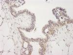 JMJD2A Antibody in Immunohistochemistry (Paraffin) (IHC (P))