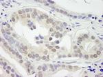 JMJD1B Antibody in Immunohistochemistry (Paraffin) (IHC (P))