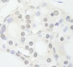 NCOA62 Antibody in Immunohistochemistry (Paraffin) (IHC (P))