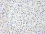 NCOA62 Antibody in Immunohistochemistry (Paraffin) (IHC (P))