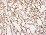 RecQ1 Antibody in Immunohistochemistry (Paraffin) (IHC (P))