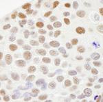 RecQ1 Antibody in Immunohistochemistry (Paraffin) (IHC (P))