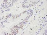 RecQ1 Antibody in Immunohistochemistry (Paraffin) (IHC (P))