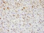 RCH1/KPNA2 Antibody in Immunohistochemistry (Paraffin) (IHC (P))