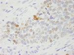 RCH1/KPNA2 Antibody in Immunohistochemistry (Paraffin) (IHC (P))