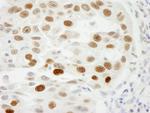 RCH1/KPNA2 Antibody in Immunohistochemistry (Paraffin) (IHC (P))