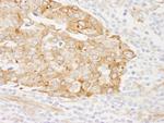 Reticulocalbin-1 Antibody in Immunohistochemistry (Paraffin) (IHC (P))