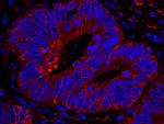 Reticulocalbin-1 Antibody in Immunohistochemistry (Paraffin) (IHC (P))