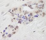 STAT6 Antibody in Immunohistochemistry (Paraffin) (IHC (P))