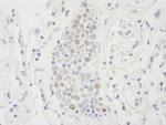 SUPT6H Antibody in Immunohistochemistry (Paraffin) (IHC (P))