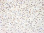 SUPT6H Antibody in Immunohistochemistry (Paraffin) (IHC (P))