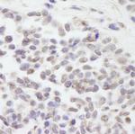 Cul3 Antibody in Immunohistochemistry (Paraffin) (IHC (P))