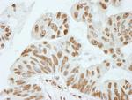 XRN2 Antibody in Immunohistochemistry (Paraffin) (IHC (P))