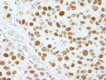 XRN2 Antibody in Immunohistochemistry (Paraffin) (IHC (P))