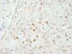 SMARCB1/SNF5 Antibody in Immunohistochemistry (Paraffin) (IHC (P))