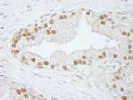 CPSF73 Antibody in Immunohistochemistry (Paraffin) (IHC (P))