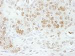 CPSF73 Antibody in Immunohistochemistry (Paraffin) (IHC (P))