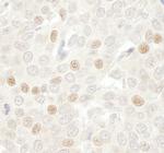 CDC20 Antibody in Immunohistochemistry (Paraffin) (IHC (P))