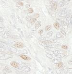 CDC20 Antibody in Immunohistochemistry (Paraffin) (IHC (P))