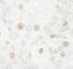 CDC20 Antibody in Immunohistochemistry (Paraffin) (IHC (P))