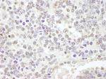 USP47 Antibody in Immunohistochemistry (Paraffin) (IHC (P))