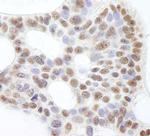 USP47 Antibody in Immunohistochemistry (Paraffin) (IHC (P))