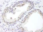 USP47 Antibody in Immunohistochemistry (Paraffin) (IHC (P))