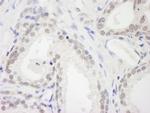 RBM12 Antibody in Immunohistochemistry (Paraffin) (IHC (P))