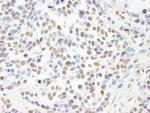 RbBP4 Antibody in Immunohistochemistry (Paraffin) (IHC (P))