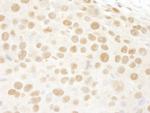 RbBP4 Antibody in Immunohistochemistry (Paraffin) (IHC (P))