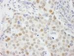 GTF3C4/TFIIIC90 Antibody in Immunohistochemistry (Paraffin) (IHC (P))