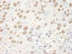 CPSF68 Antibody in Immunohistochemistry (Paraffin) (IHC (P))