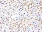 CPSF68 Antibody in Immunohistochemistry (Paraffin) (IHC (P))