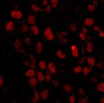 CPSF68 Antibody in Immunohistochemistry (Paraffin) (IHC (P))