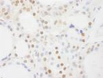 BRF1 Antibody in Immunohistochemistry (Paraffin) (IHC (P))