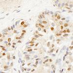 BRF1 Antibody in Immunohistochemistry (Paraffin) (IHC (P))