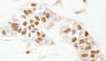 PARP1 Antibody in Immunohistochemistry (Paraffin) (IHC (P))