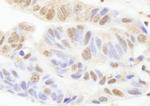 PARP1 Antibody in Immunohistochemistry (Paraffin) (IHC (P))