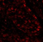 PARP1 Antibody in Immunohistochemistry (Paraffin) (IHC (P))