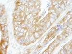 CAD Antibody in Immunohistochemistry (Paraffin) (IHC (P))