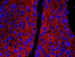 CAD Antibody in Immunohistochemistry (Paraffin) (IHC (P))