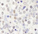 HDAC7 Antibody in Immunohistochemistry (Paraffin) (IHC (P))