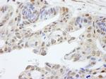 UACA Antibody in Immunohistochemistry (Paraffin) (IHC (P))