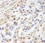 UACA Antibody in Immunohistochemistry (Paraffin) (IHC (P))