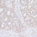 CTR9 Antibody in Immunohistochemistry (Paraffin) (IHC (P))