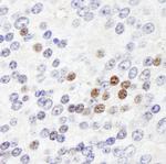 ZHX3 Antibody in Immunohistochemistry (Paraffin) (IHC (P))